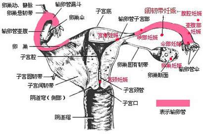 随州女性得了宫外孕会有什么早期症状